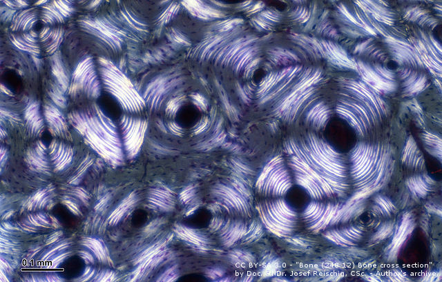 Microscope cross section of bone