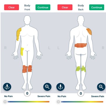 Manchester Digital Pain Manikin from a smartphone-based app which enables users to self-report the location and intensity of their pain.